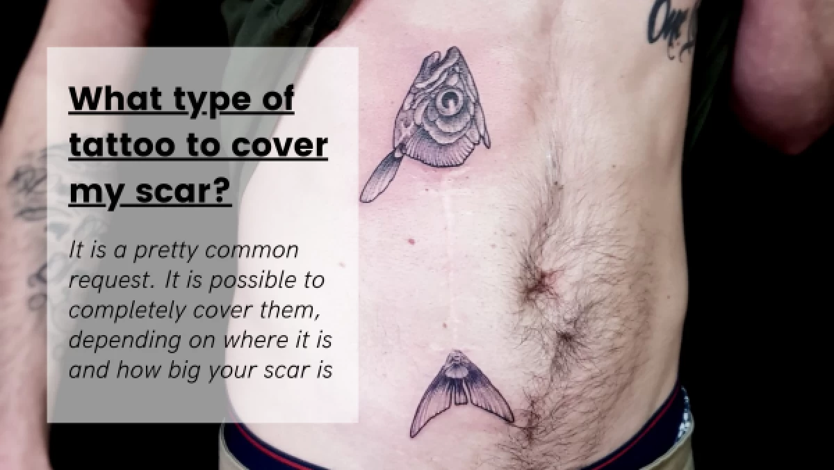 Scar & Brazilian Stretch Mark Tattoo Camouflage FAQs - Ink Illusions