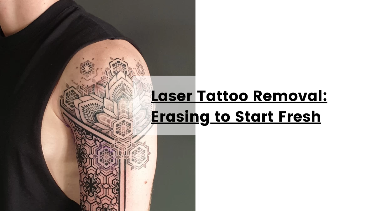 Laser Tattoo Removal_ Erasing to Start Fresh